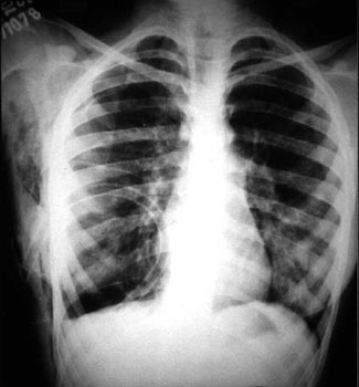 20080226 mgb Radiografía .jpg