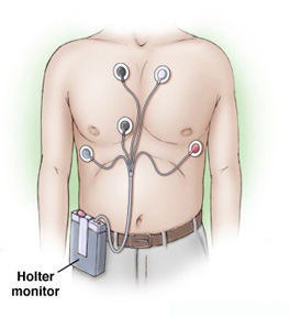 20110426 mgb Holter .jpg