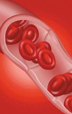 20071022 mgb anemia .jpg