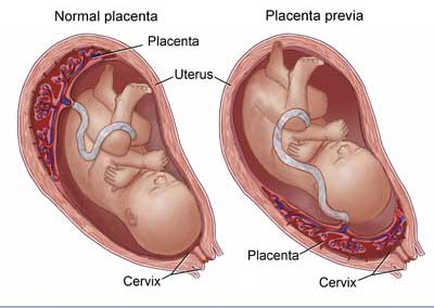 20120207 mgb Placenta .jpg