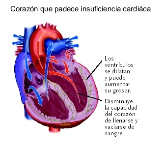 20080512 mgb Insuficiencia cardíaca .jpg