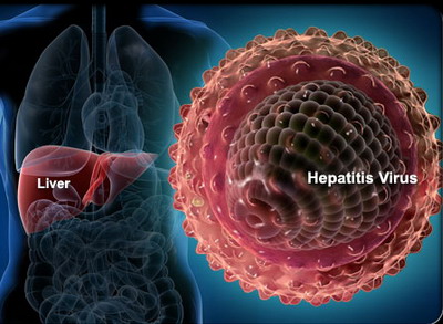 20110526 mgb Hepatitis D .jpg