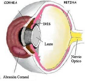 20071106 mgb cornea .jpg