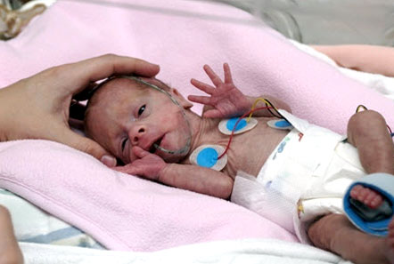 20120206 mgb Bebé prematuro .jpg