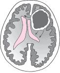 20071106 mgb cerebro .jpg